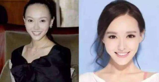 有很多女明星都有大额头的问题,有一部分女星是因为是天生额发高,有一