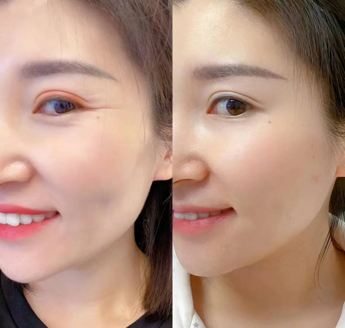 抗皱眼霜排行榜.口碑高的抗皱眼霜