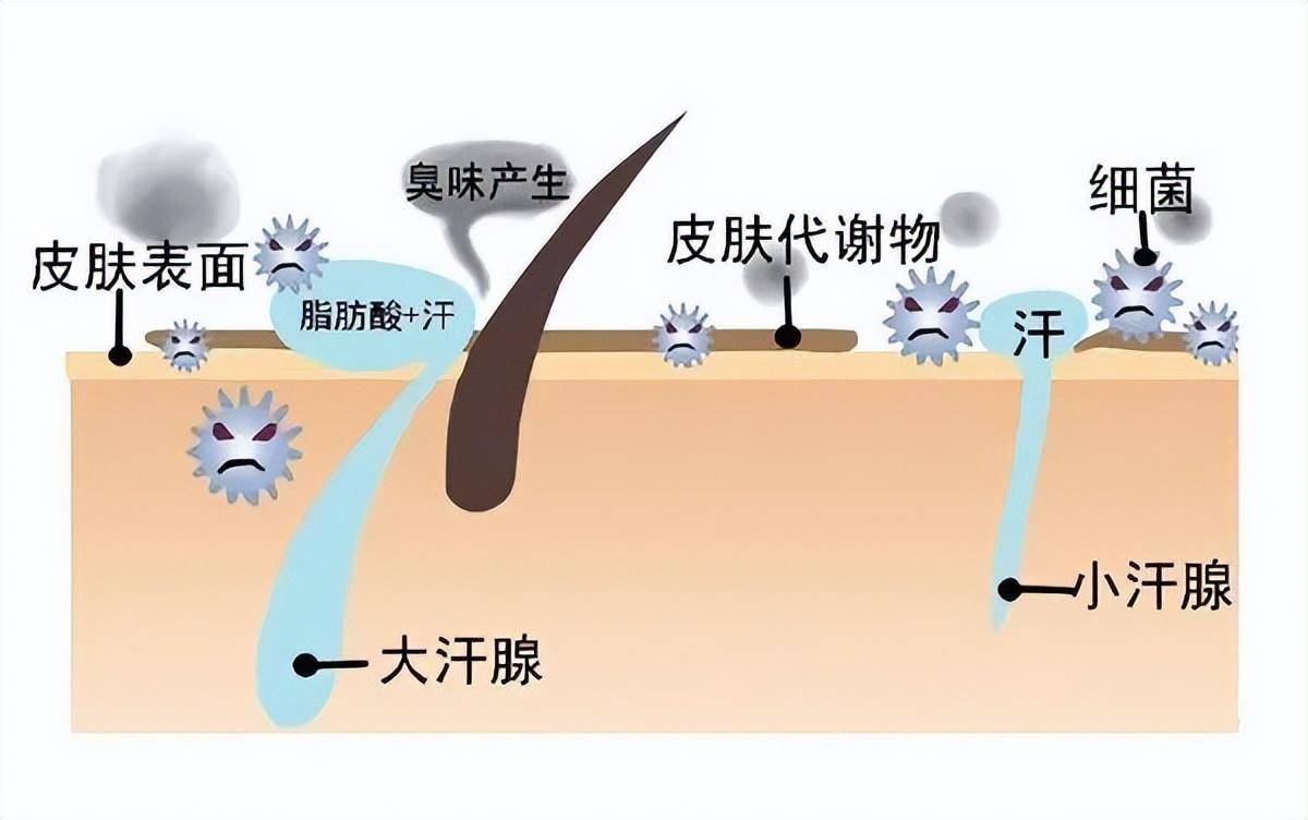 穿狐臭患者穿过的衣服,真的会传染狐臭吗?_味道_脂肪酸_遗传性