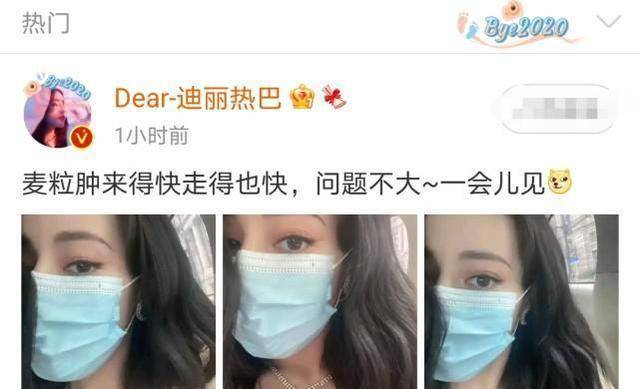 迪丽热巴穿人鱼公主裙亮相戴墨镜直播是因为眼部长了个麦粒肿