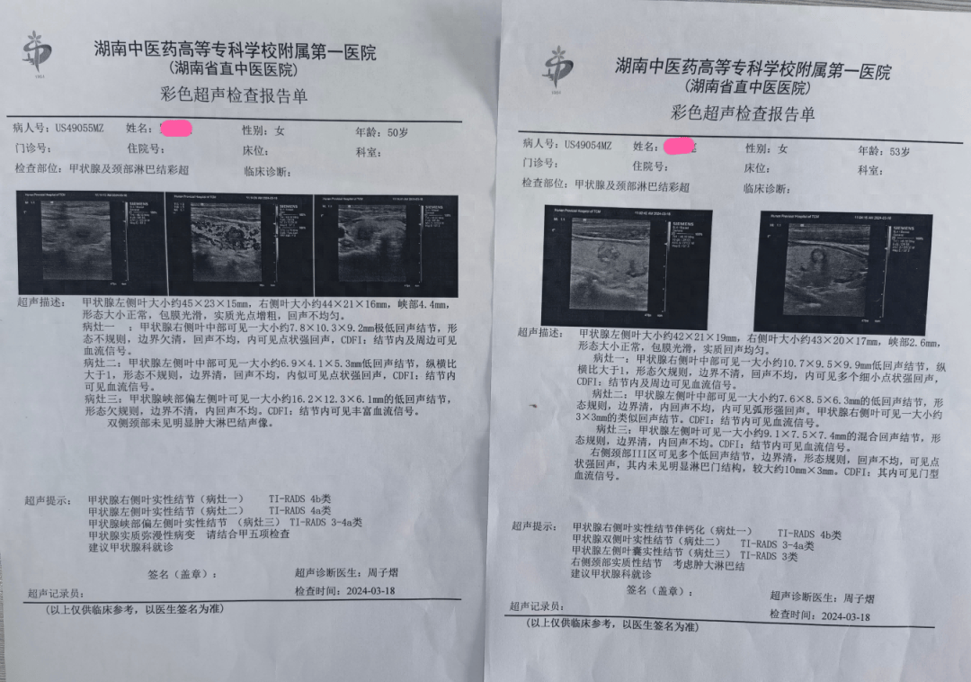 颈动脉超声报告单图片图片