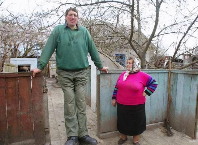 原创载入史册的奇男子21岁以前患侏儒症21岁后患巨人症享年51岁