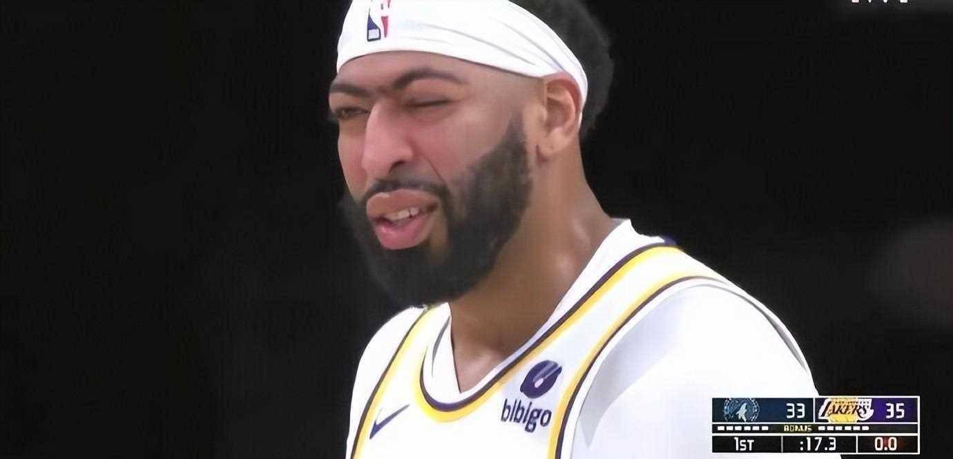 浓眉谈被李凯尔打伤左眼眼睛像被撕开一样啥都看不见不停流眼