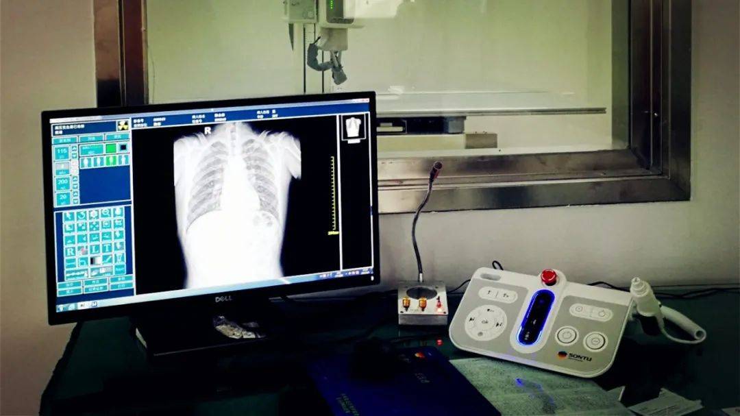 14日,河南省周口市卫生健康委执法人员对某医院dr检查室进行监督检查