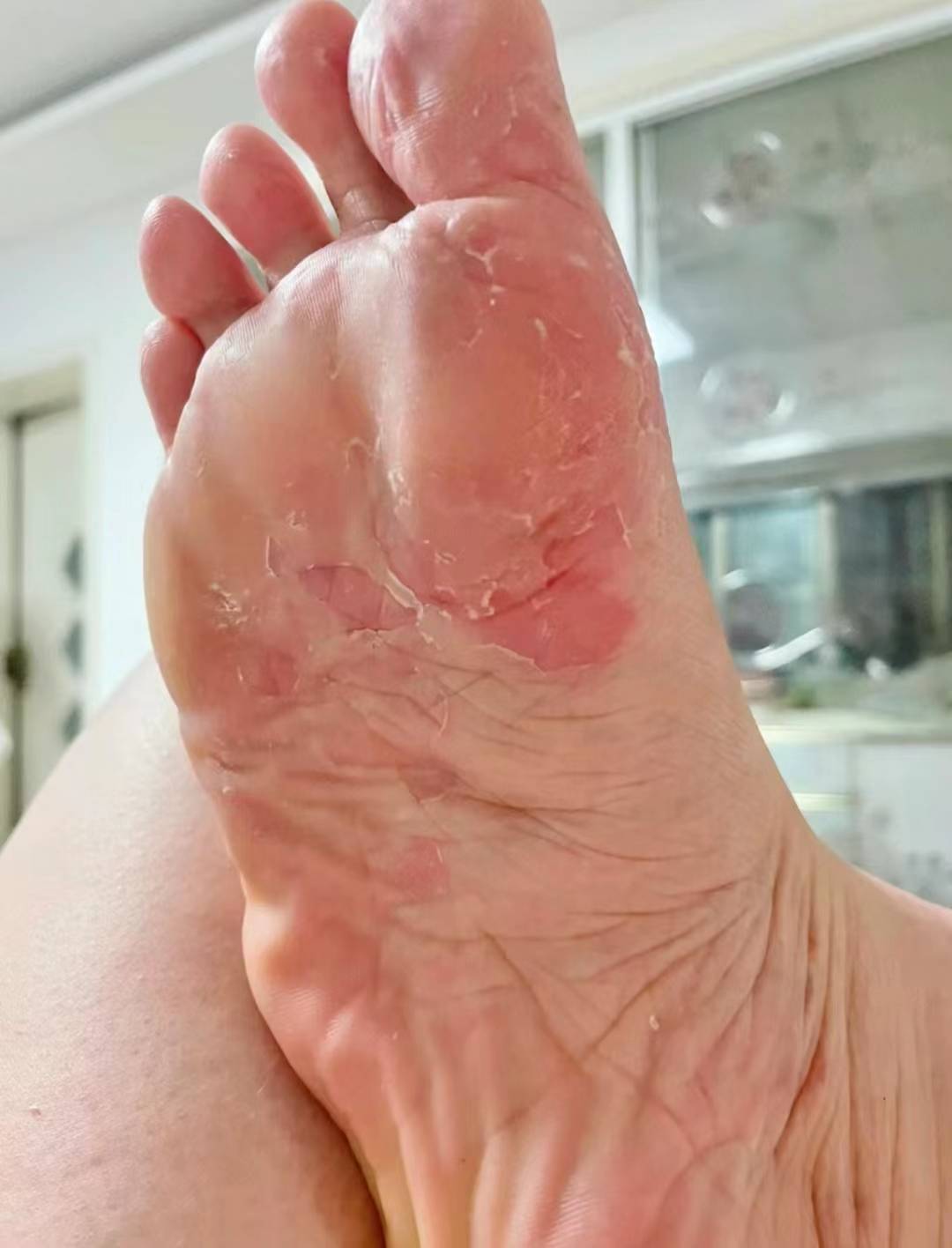 每天照做轻松搞定脚臭脚汗!_按摩_脚趾_问题