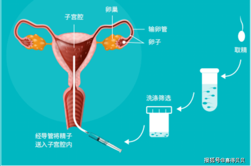 喜得贝贝:一个17岁的女孩因为从未经历过月经,被诊断为"石女".