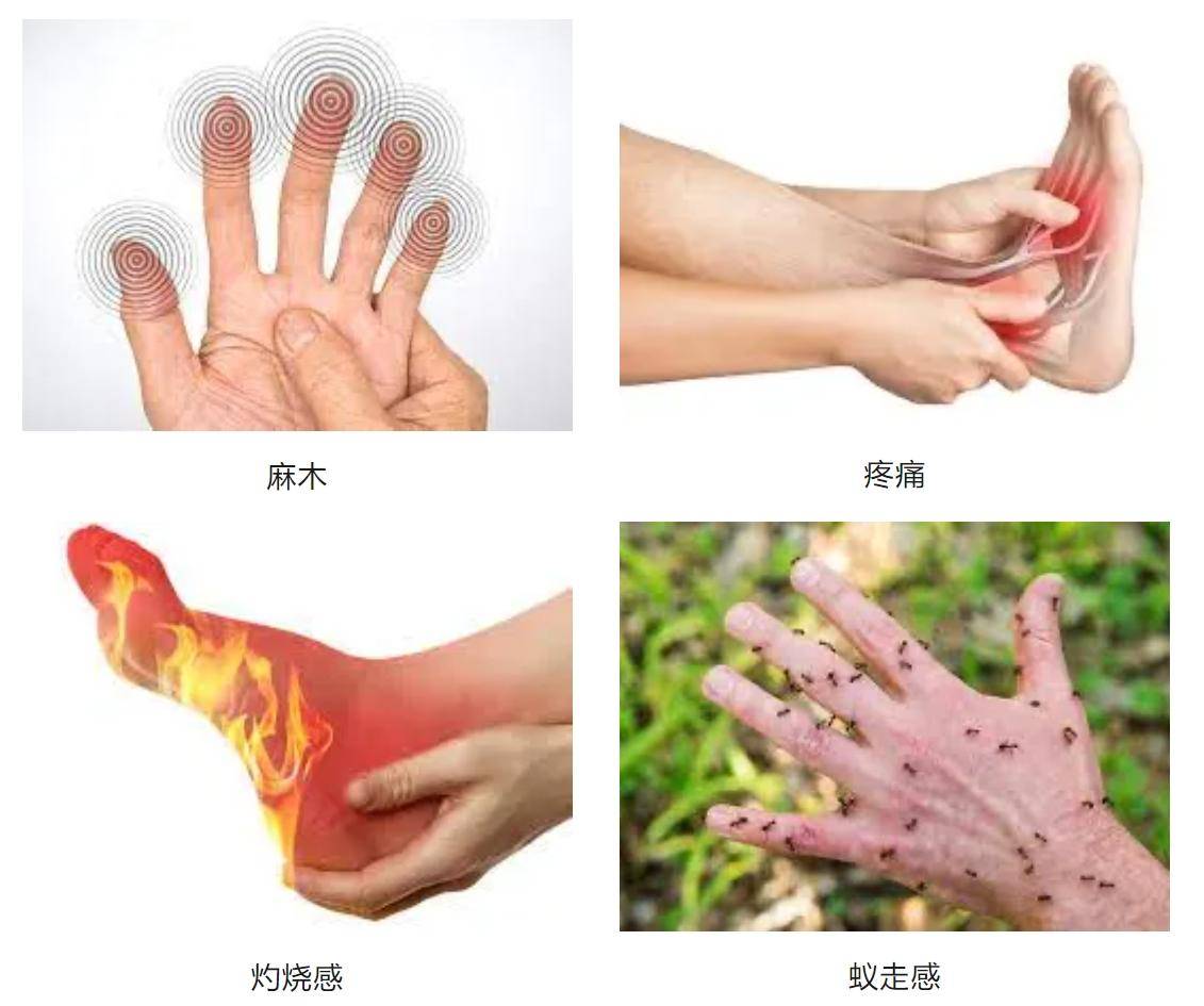 糖尿病患者手脚疼痛,麻木,蚁走感?小心糖尿病神经病变