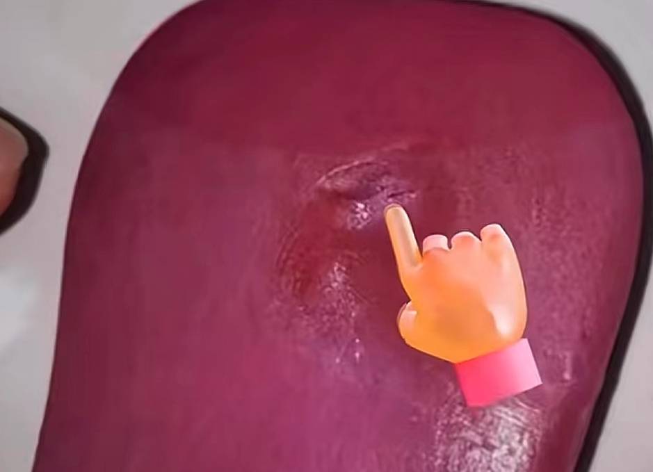 舒肤佳香皂一个月两次出现刀片 男子称腰部被划伤10余厘米(图1)