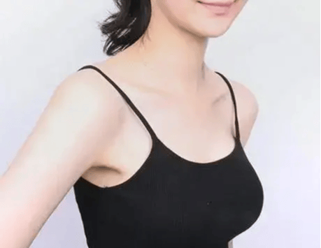 南阳艾美整形:脂肪丰胸有什么危害和后遗症吗