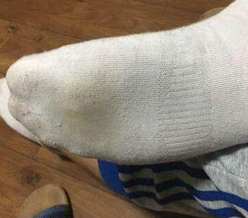 如果你穿的是白袜子,可试试以下几个方法:白袜子变黄以后,用洗衣粉加