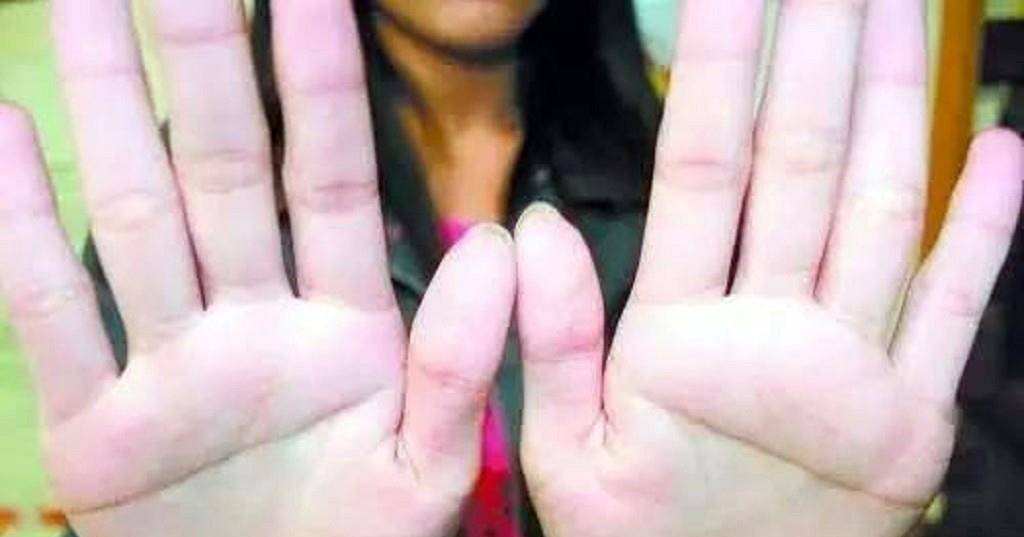 为什么断掌就能拥有主角光环?