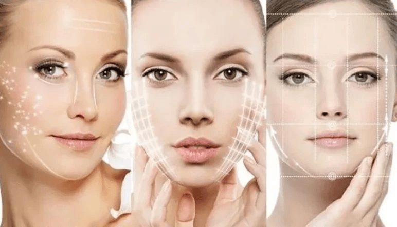 知情人解释具体什么是快翎线雕,做了快翎线雕一般可以维持多久