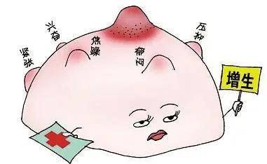 是囊肿,也不是炎症,只是乳腺组织的增生,增大,具体的表现就是乳房胀痛