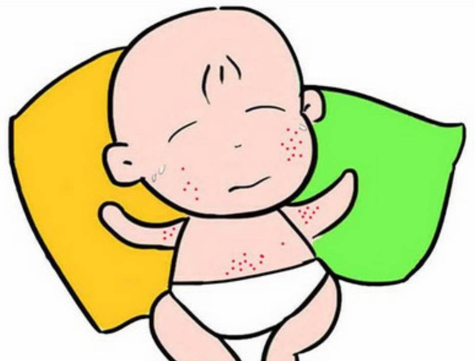 宝宝夏季皮肤护理 新手爸妈快收藏哦!