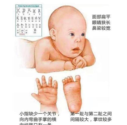广东83岁老太毒杀46岁智障儿子,被捕后声泪俱下,称自己养不动了