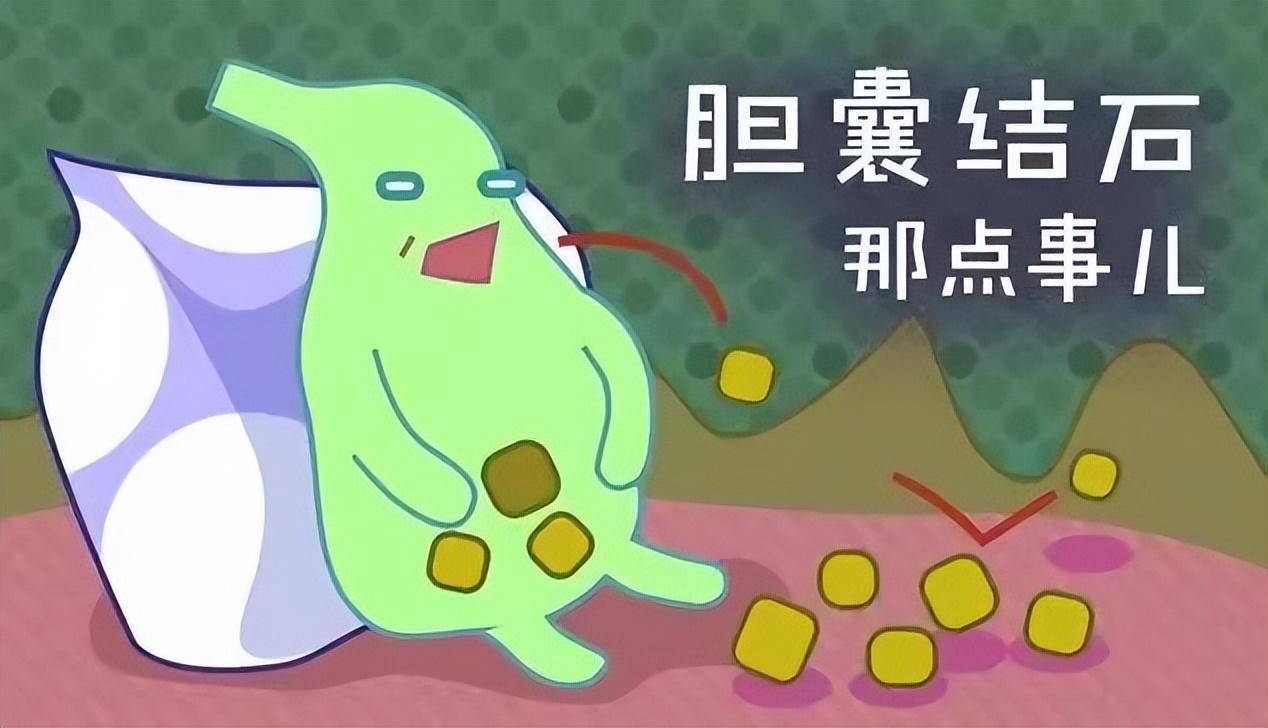 胆囊结石卡通图片图片