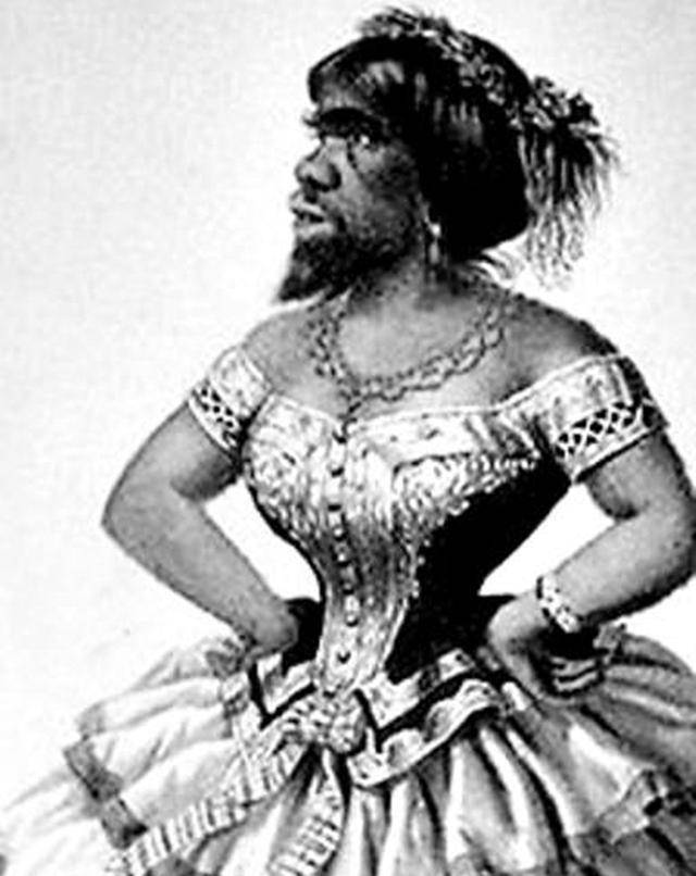 她被称为最丑的女人,却被20个男人追求,死后被丈夫做成标本展览