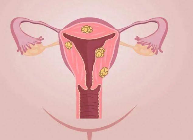 女人摘掉子宫后,与正常女性有何差异呢?妇科医生道出实情