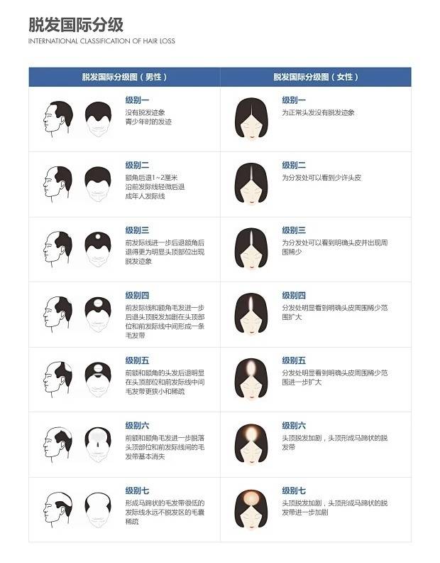 生发品牌中国前十名:榜一助你释放无限发量_头皮_头发_效果