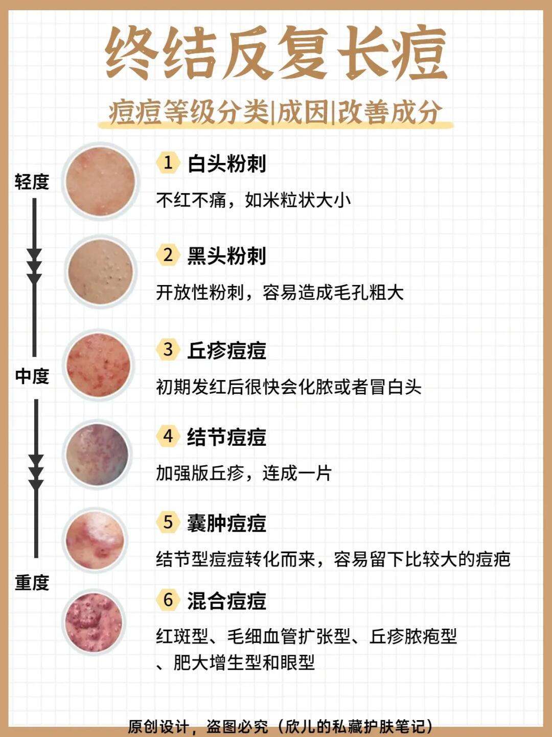 痘痘消除术,让你告别瑕疵,重拾光滑肌肤!脸上祛痘印最有效方法