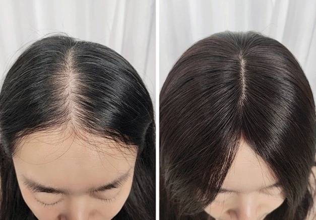 女性防止脱发的发型图片