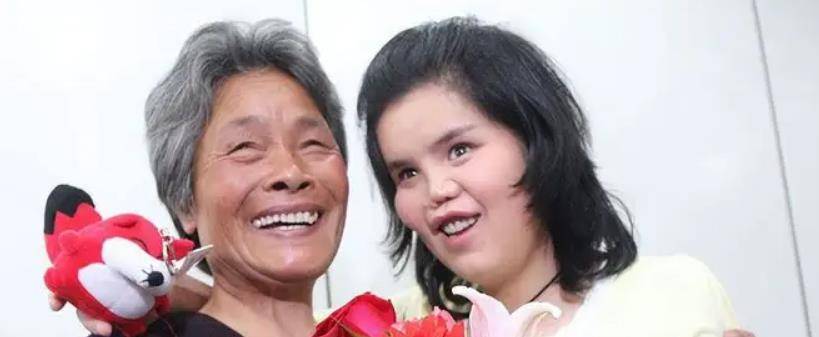 88年陕西农民捡到坑面女婴,哥哥赚钱为她整容,变美后她嫁给哥哥