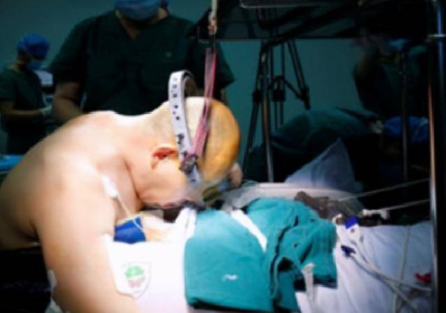 身体"折叠"28年,历经四次艰难手术,"折叠人"李华终重获新生