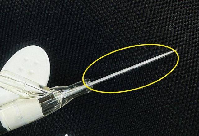 留置针导管在婴儿血管里漂移5年-留置针对小孩血管有影响吗