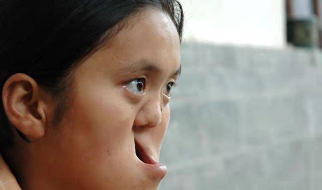 1988年,陕西农民捡到面部畸形女婴,整容变美后嫁给了农民儿子