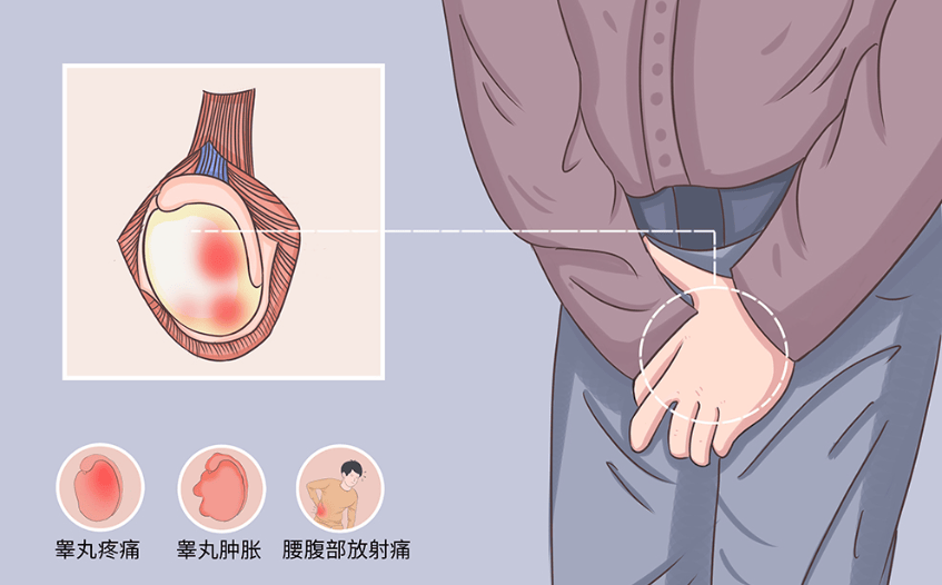 男人蛋疼是什么原因图片