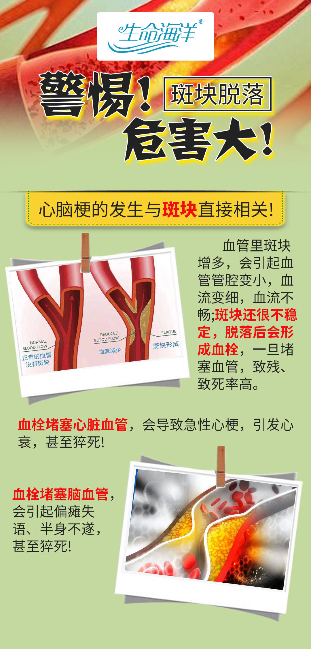 生命海洋治疗仪| 颈动脉斑块脱落,有先兆吗?