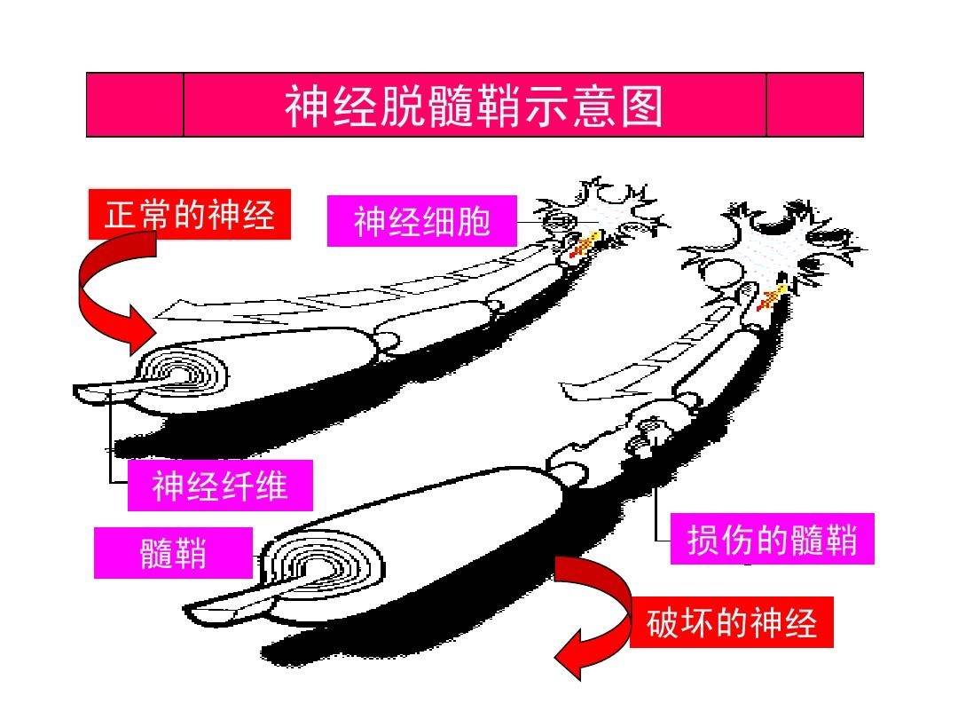 髓索和髓窦图片