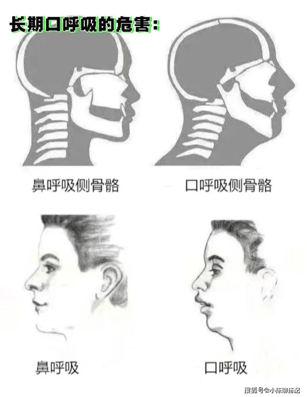 不然脸会变得很丑:前面我们提及先天发育的骨骼型,虽然看似好像只有