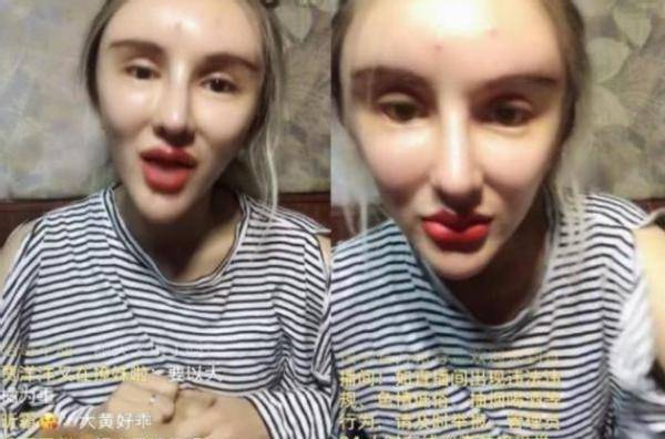 红粉宝宝:16岁开始整容,花400万整容200多次,今坐轮椅悔不当初