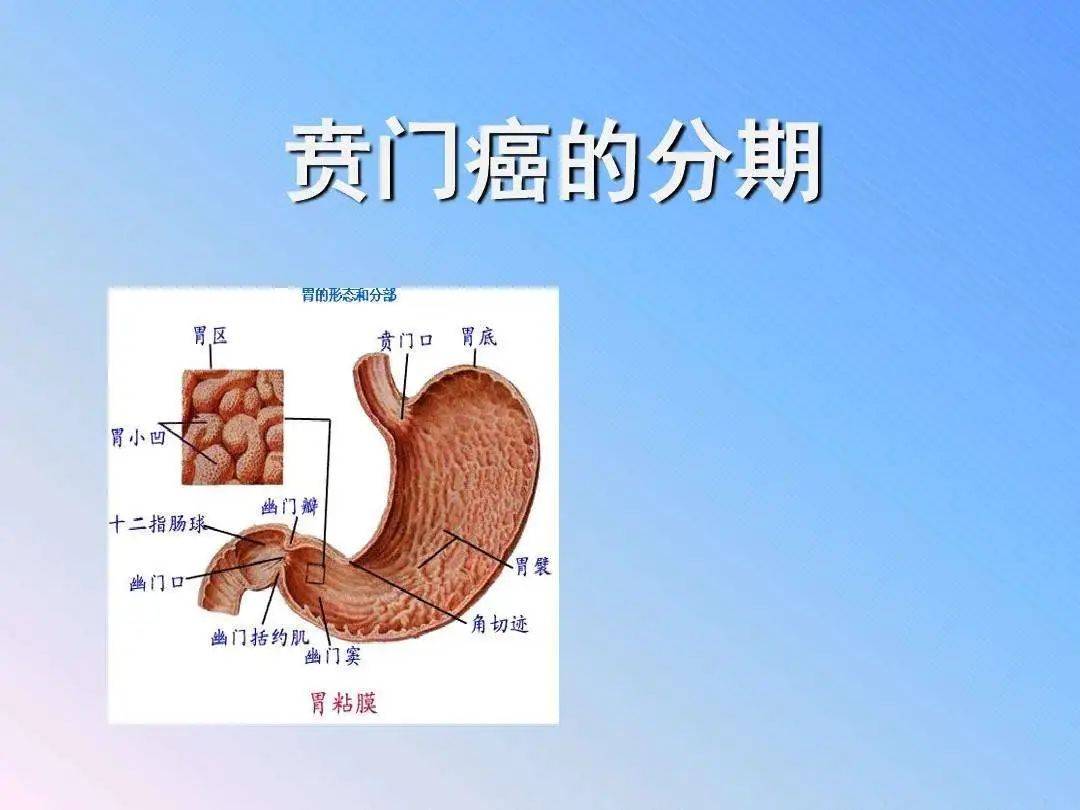 中信惠州医院肿瘤科——贲门癌有什么症状?需要切胃治疗吗?