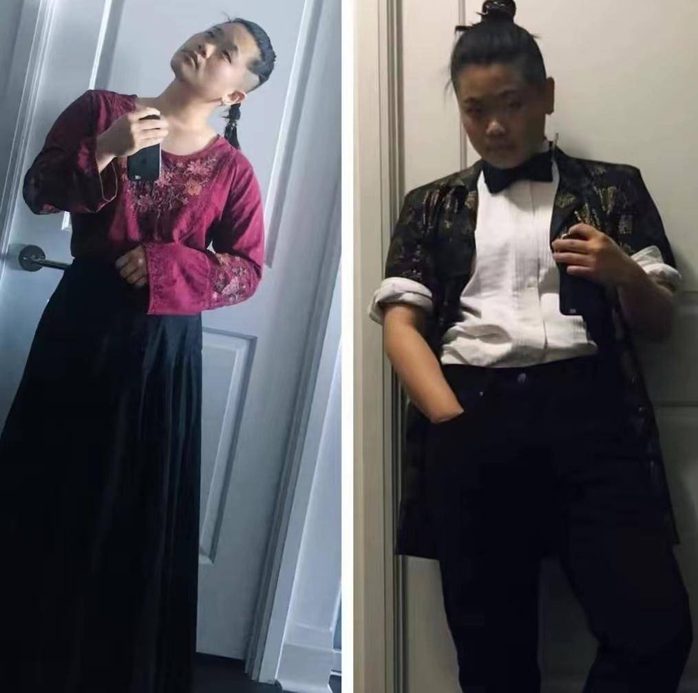 其实对于这样的外貌,毕凌也是非常乐观和坦然的,因为她觉得每一个人都