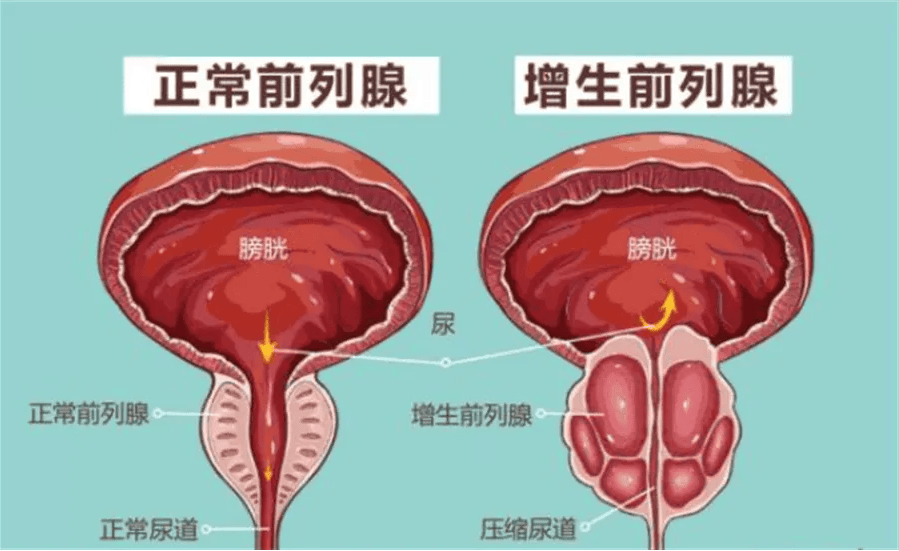 哪治男科好（治男科哪里好） 哪治男科好（治男科那边

好）《哪个治男科好》 男科男健