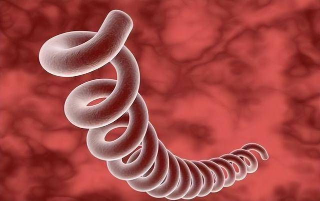 梅毒喜欢玩"潜伏",若身体出现5个不适症状,不妨多注意