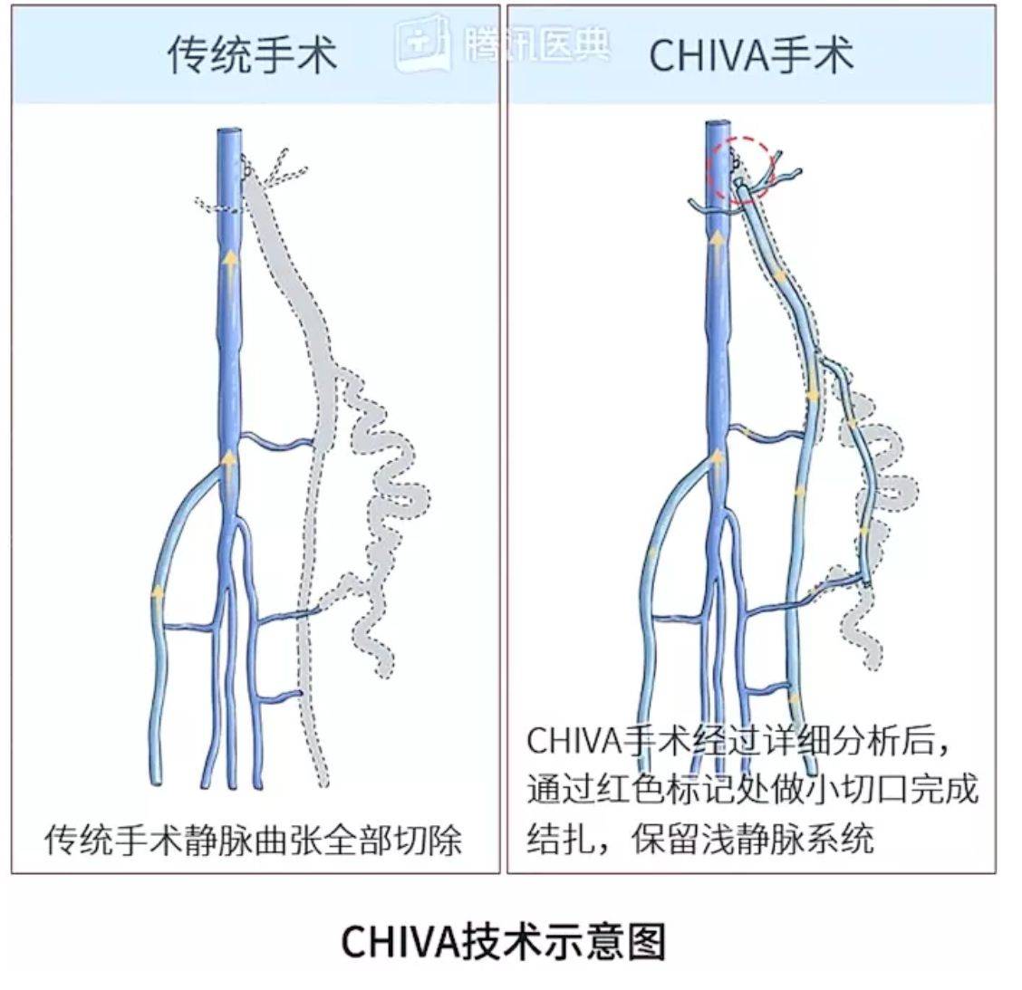 平行脉与网状脉图片