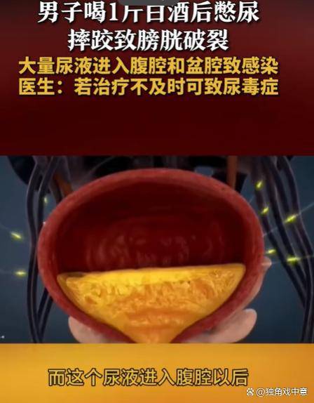 男子酒后憋尿20小时致膀胱破裂