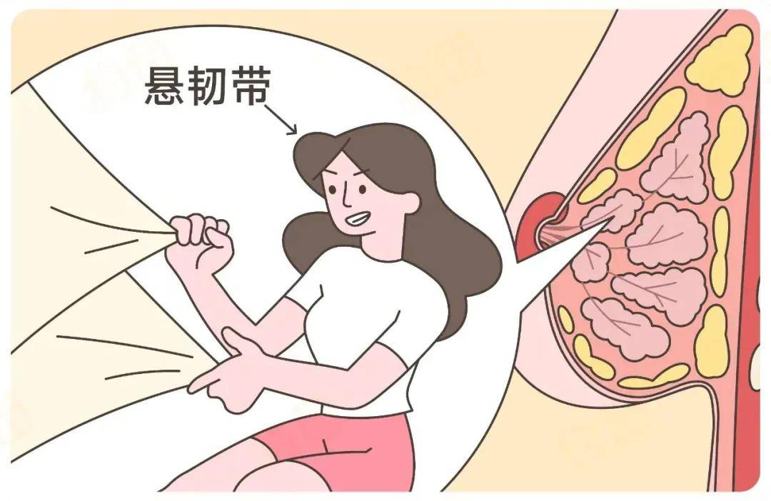 乳房悬韧带断裂图片图片