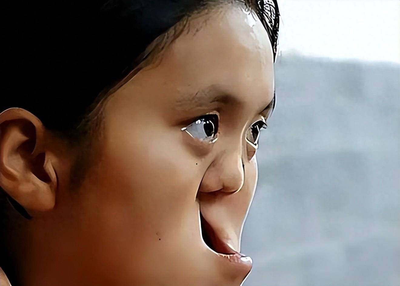 陕西夫妇捡到"坑脸"女婴,整容后颜值逆天,竟然与自己哥哥结婚