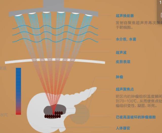 蝙蝠超声波原理图片