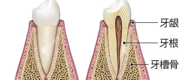 邢台种植专家:缺牙太久牙槽骨萎缩严重,无法"扎根"怎么办?