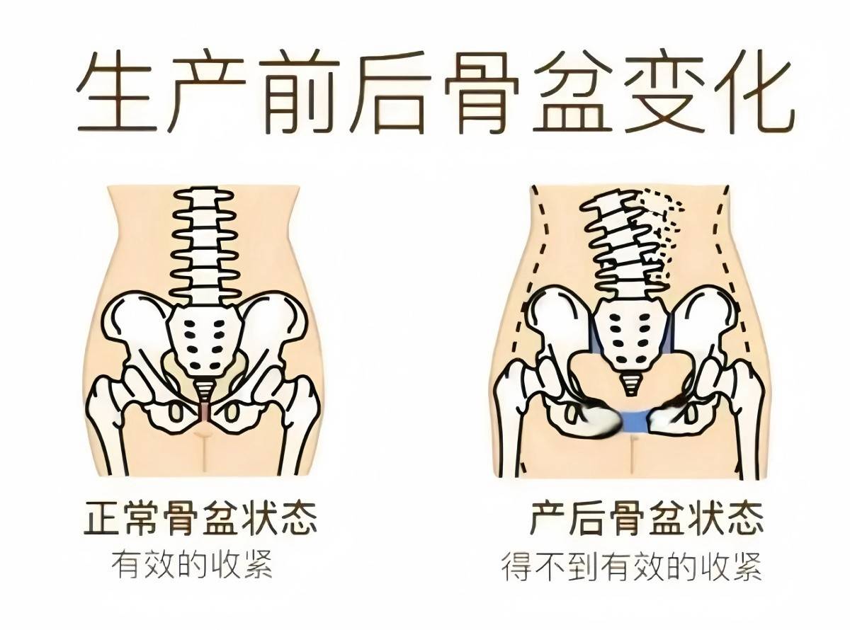 怎么判断一个女人生没生过孩子？这些变化想藏都藏不住