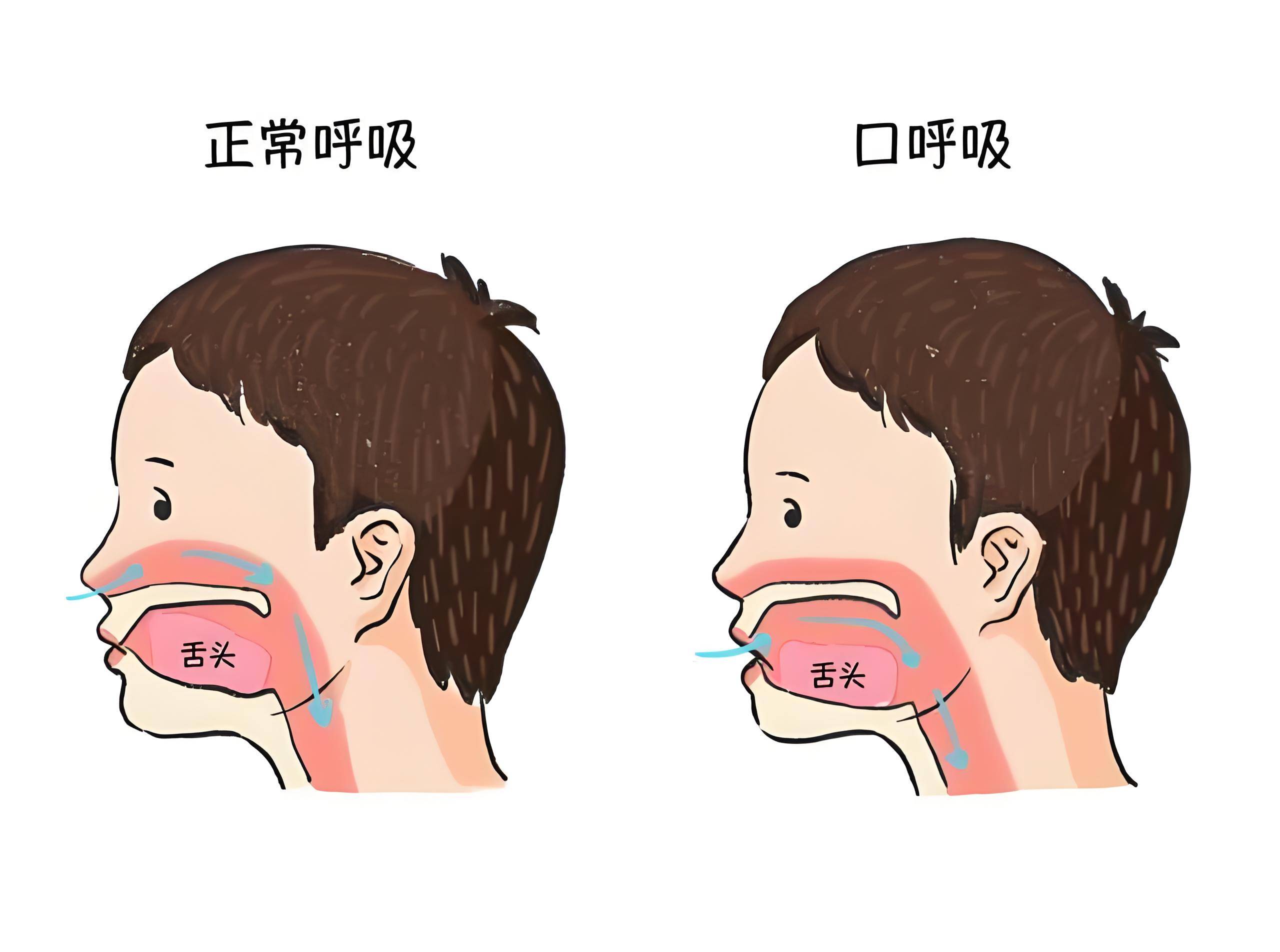 嘉兴曙光口腔爱牙科普|口腔不良习惯对口腔健康有什么影响?