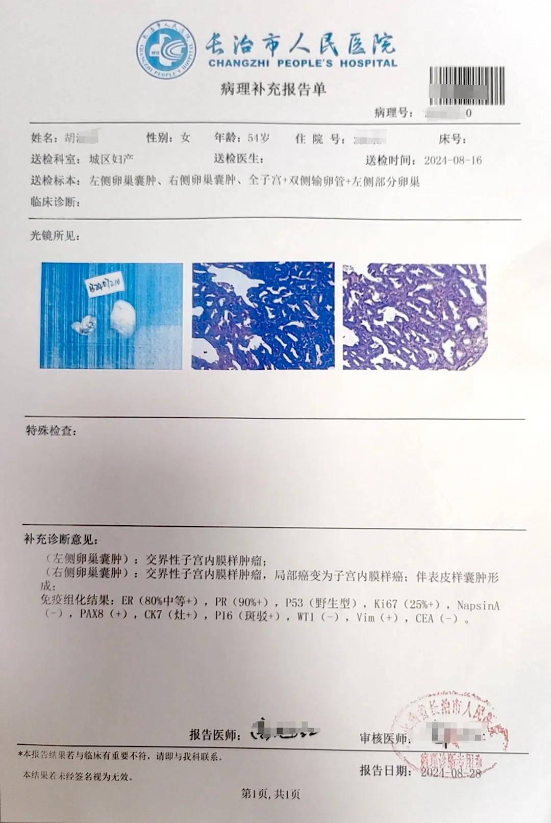 蛛网膜囊肿报告图片