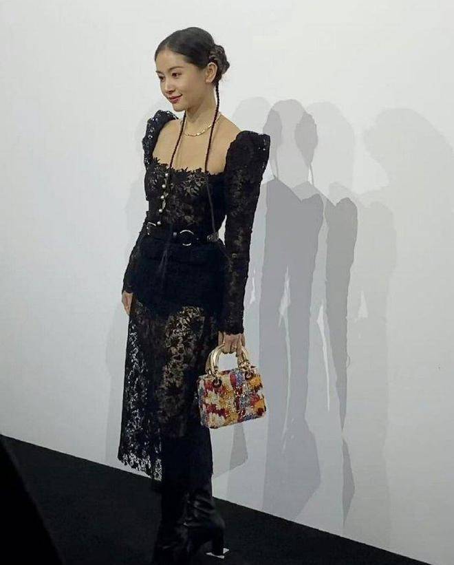 37岁王子文大变样!脸部肿胀扭曲不敢认,网友辣评:医美后遗症