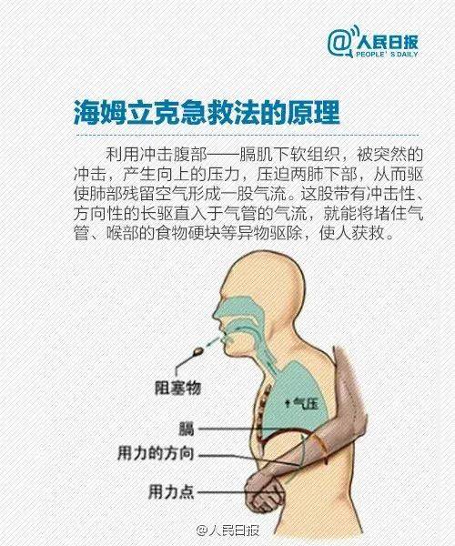 日常生活中,无论婴幼儿还是成人,都有可能面临被异物卡喉窒息的危险