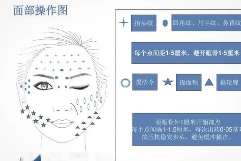 三线提升能维持多久?